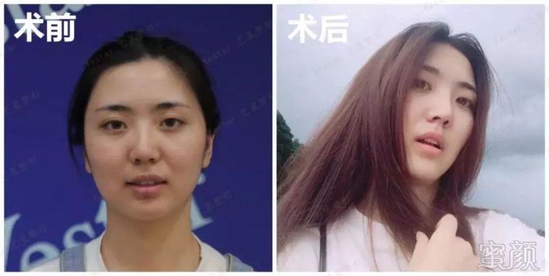 案例图片