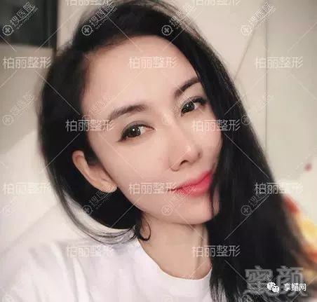 案例图片