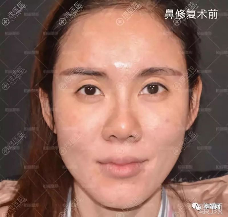 案例图片