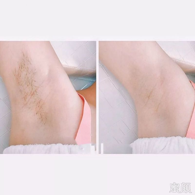 https://img.miyanlife.com/mnt/timg/190222/1253111020-4.jpg