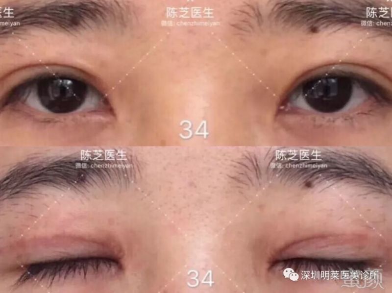 https://img.miyanlife.com/mnt/timg/190222/13141M062-3.jpg