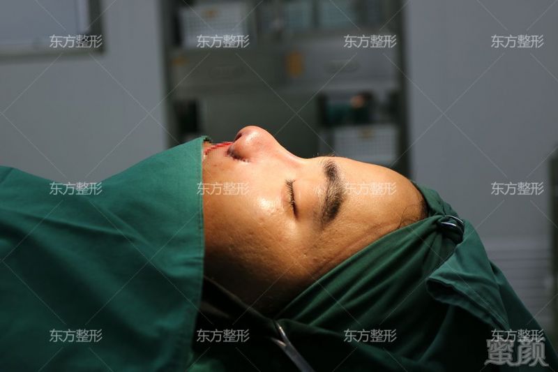 https://img.miyanlife.com/mnt/timg/190223/1239242b6-8.jpg