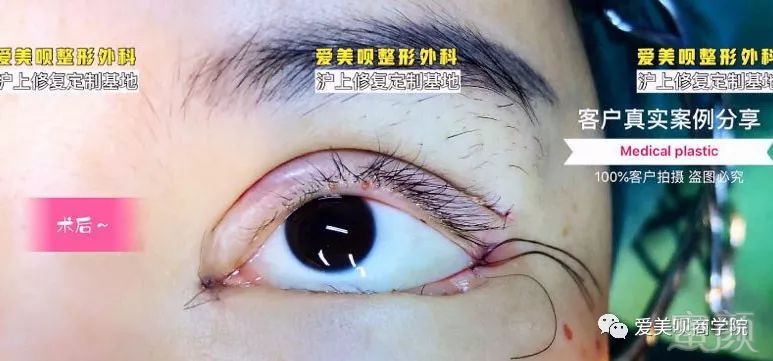 案例图片