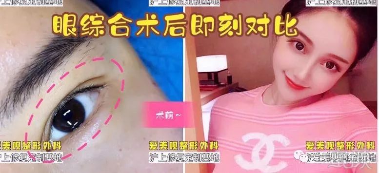 案例图片