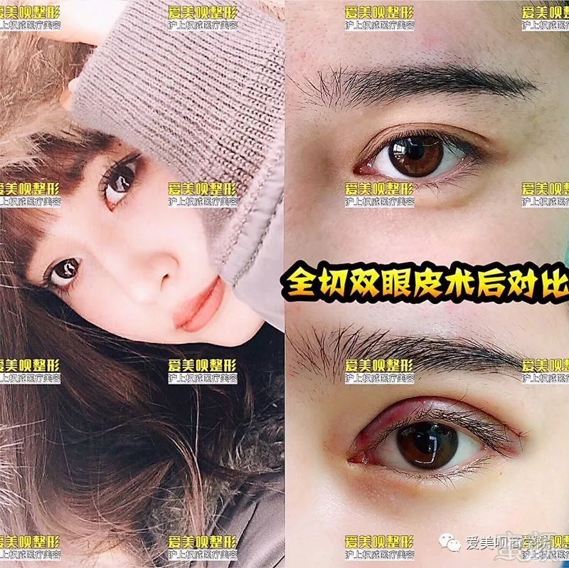 案例图片