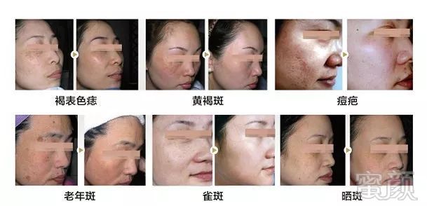 https://img.miyanlife.com/mnt/timg/190223/12515TE5-1.jpg
