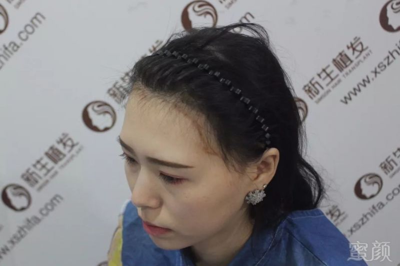 https://img.miyanlife.com/mnt/timg/190223/12545B562-2.jpg