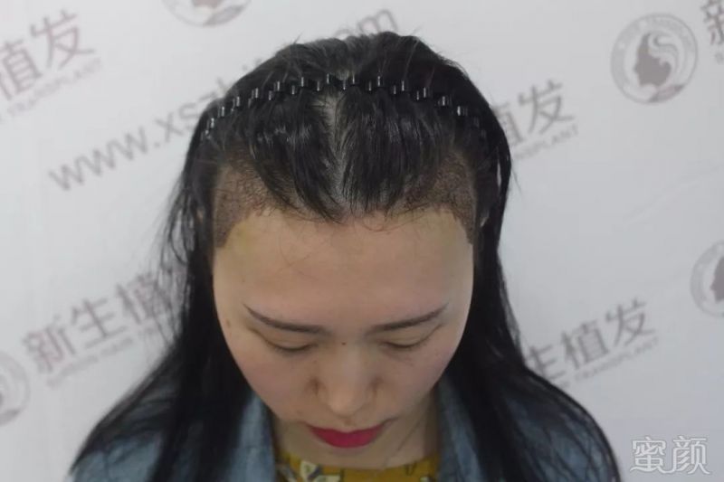 https://img.miyanlife.com/mnt/timg/190223/12545IW7-7.jpg