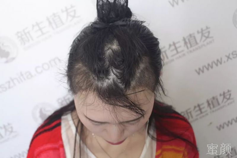 https://img.miyanlife.com/mnt/timg/190223/12545W408-9.jpg