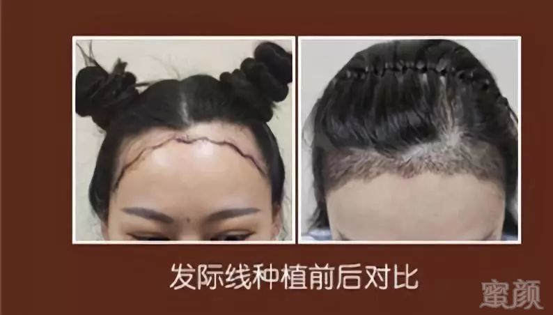 https://img.miyanlife.com/mnt/timg/190223/12552460T-7.jpg