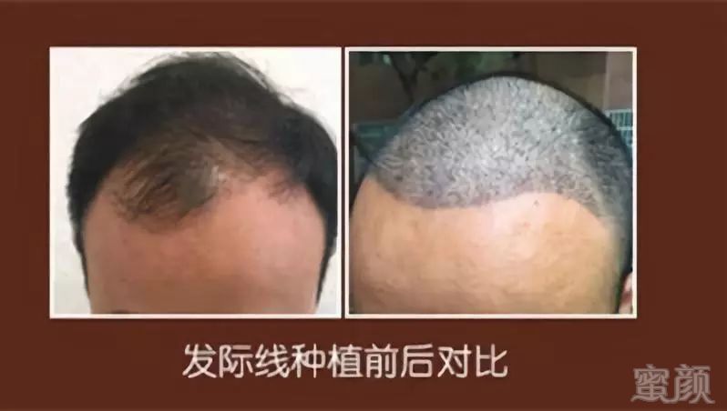 https://img.miyanlife.com/mnt/timg/190223/1255246110-8.jpg