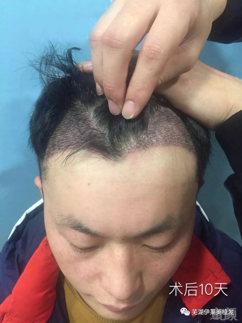 https://img.miyanlife.com/mnt/timg/190223/1256232229-4.jpg