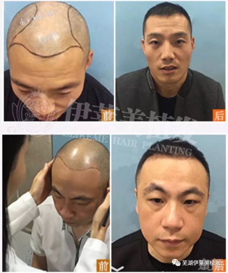https://img.miyanlife.com/mnt/timg/190223/1256245142-7.jpg