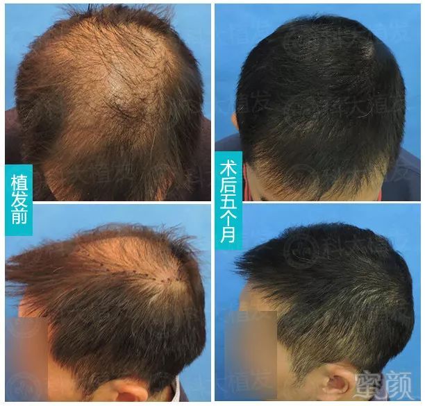 https://img.miyanlife.com/mnt/timg/190223/125641D47-4.jpg