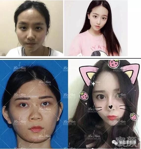 案例图片
