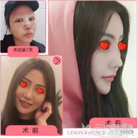 https://img.miyanlife.com/mnt/timg/190223/125I63416-1.jpg