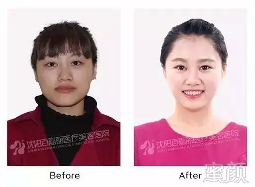 https://img.miyanlife.com/mnt/timg/190223/130A350B-6.jpg