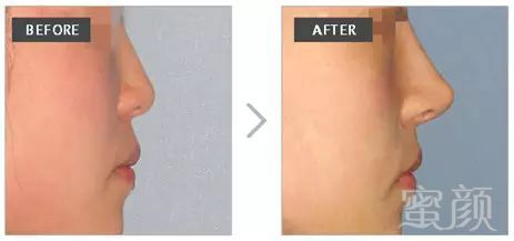 https://img.miyanlife.com/mnt/timg/190223/13430540U-3.jpg