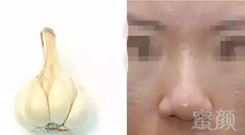 https://img.miyanlife.com/mnt/timg/190223/1343061039-7.jpg