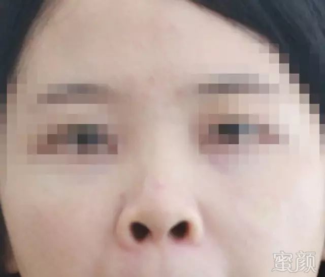 https://img.miyanlife.com/mnt/timg/190223/13430B363-10.jpg