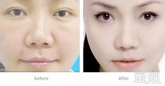 https://img.miyanlife.com/mnt/timg/190223/13430C3B-12.jpg