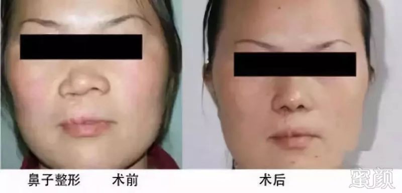 https://img.miyanlife.com/mnt/timg/190223/13441V264-11.jpg