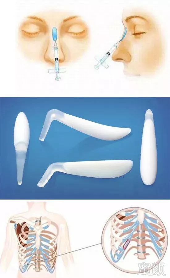 https://img.miyanlife.com/mnt/timg/190223/13441aR2-12.jpg