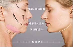 https://img.miyanlife.com/mnt/timg/190224/120151L50-4.jpg