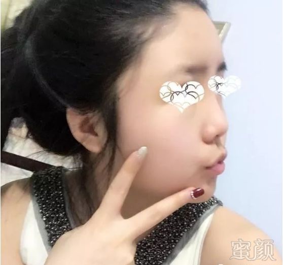 https://img.miyanlife.com/mnt/timg/190224/1206333I9-1.jpg