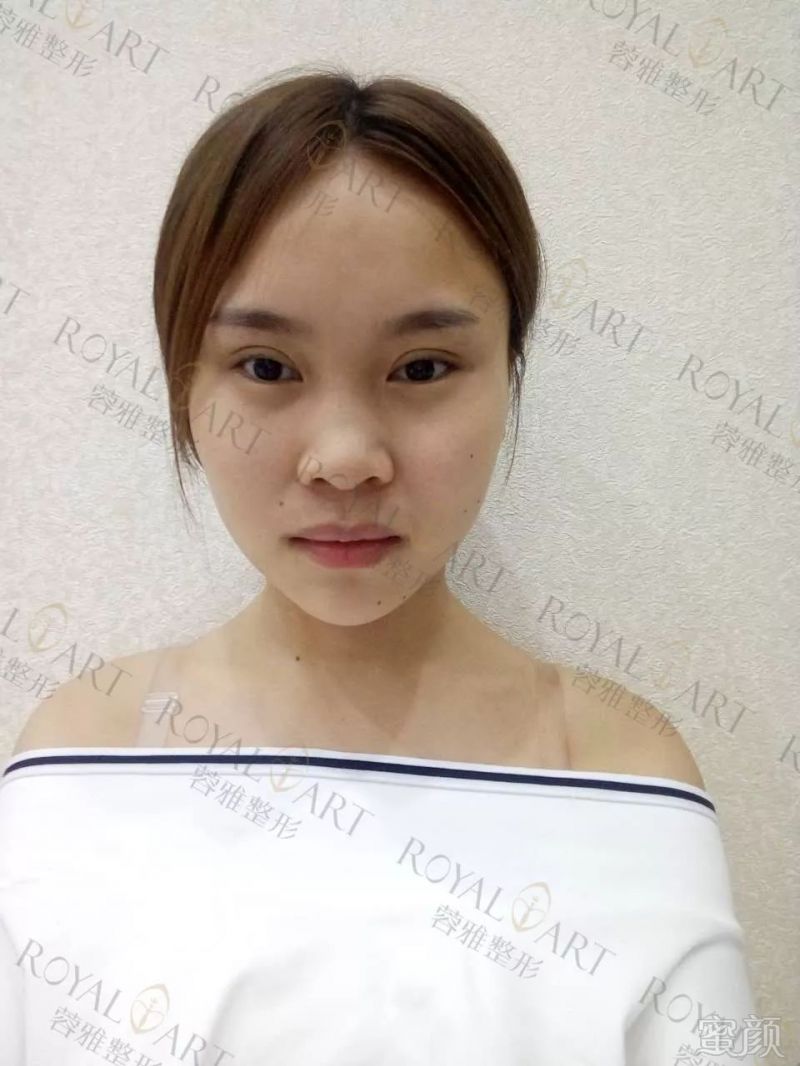 https://img.miyanlife.com/mnt/timg/190224/1212546009-1.jpg