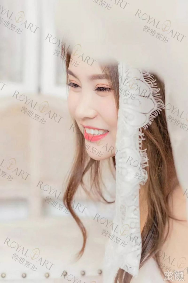https://img.miyanlife.com/mnt/timg/190224/1212561310-6.jpg