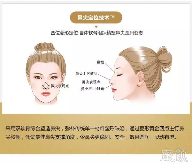 https://img.miyanlife.com/mnt/timg/190224/12125R028-11.jpg