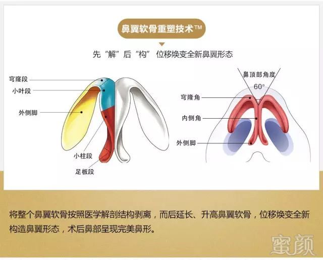 https://img.miyanlife.com/mnt/timg/190224/12125SS7-12.jpg