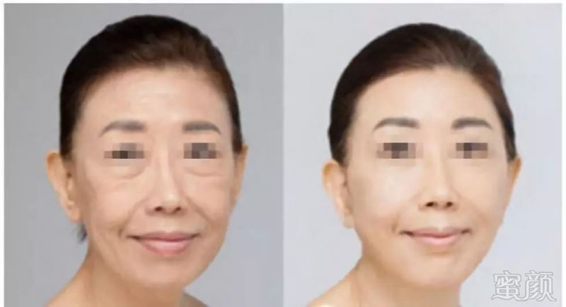 https://img.miyanlife.com/mnt/timg/190224/12244255F-5.jpg