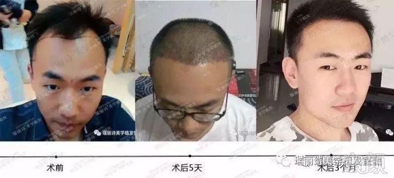 https://img.miyanlife.com/mnt/timg/190224/1241251R6-6.jpg
