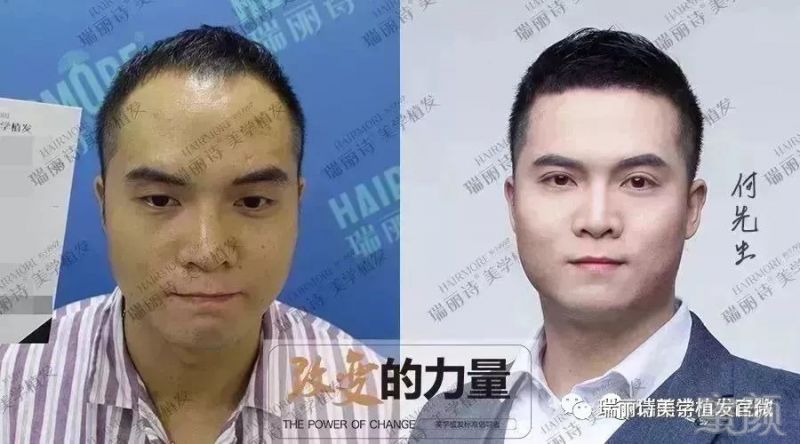 https://img.miyanlife.com/mnt/timg/190224/1241264217-11.jpg