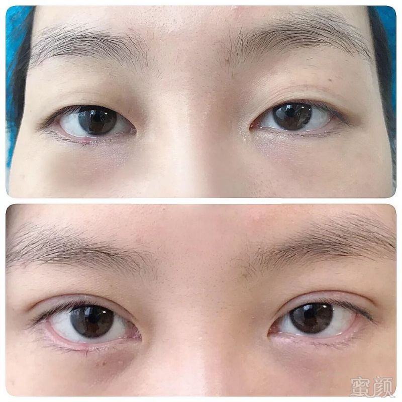 https://img.miyanlife.com/mnt/timg/190224/1336451R6-0.jpg