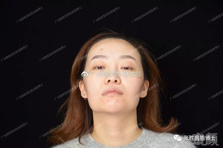 https://img.miyanlife.com/mnt/timg/190224/13461221E-1.jpg