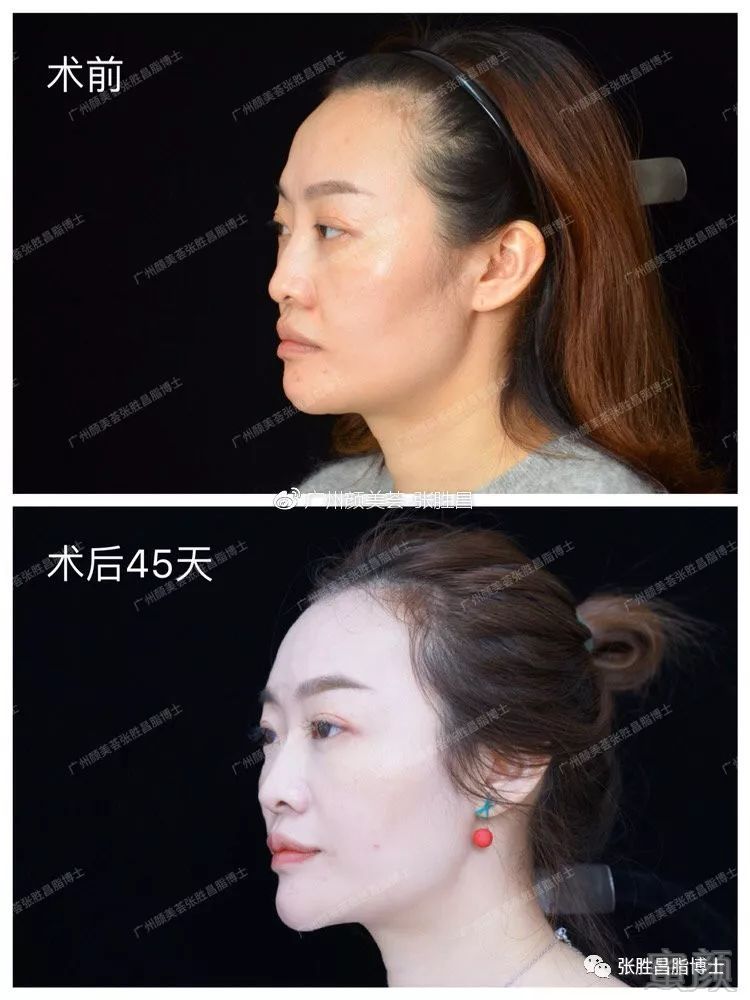 https://img.miyanlife.com/mnt/timg/190224/1346161304-15.jpg