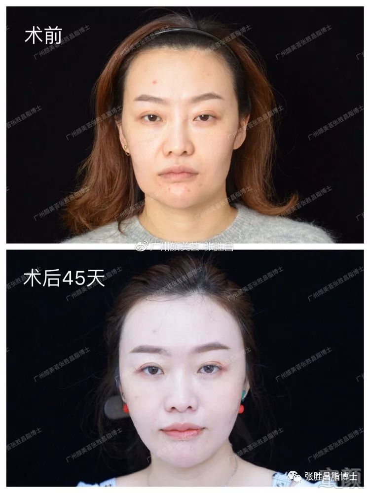 https://img.miyanlife.com/mnt/timg/190224/13461B426-13.jpg