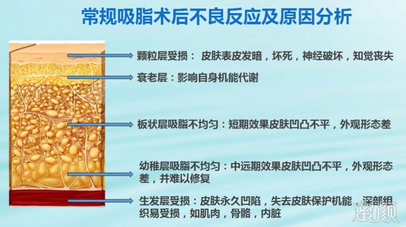 https://img.miyanlife.com/mnt/timg/190224/1354091A4-1.jpg
