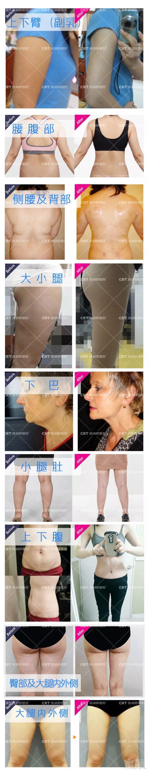 https://img.miyanlife.com/mnt/timg/190224/13541B3D-4.jpg