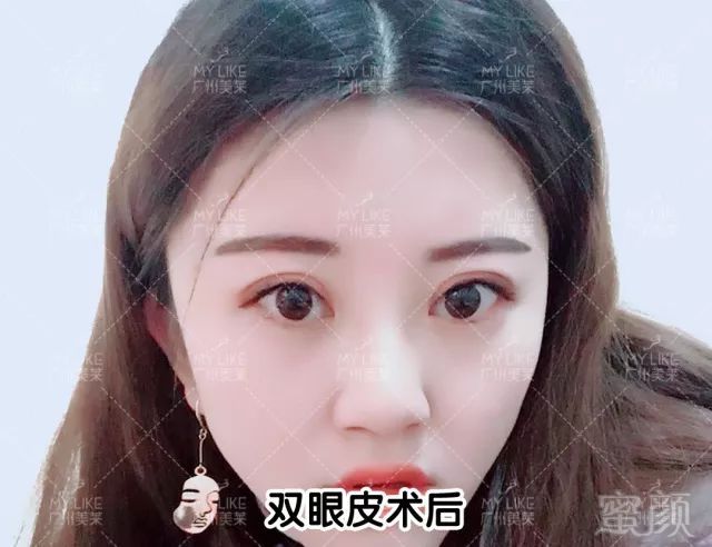 案例图片