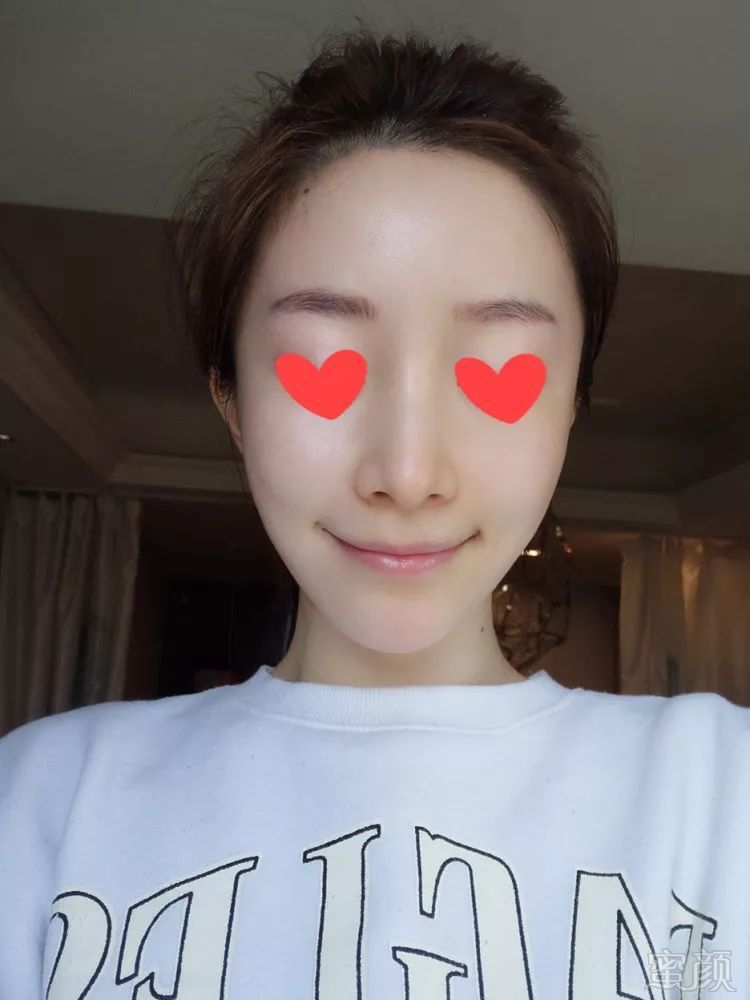 https://img.miyanlife.com/mnt/timg/190225/123133F62-3.jpg