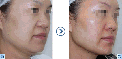 https://img.miyanlife.com/mnt/timg/190225/1232212223-6.jpg