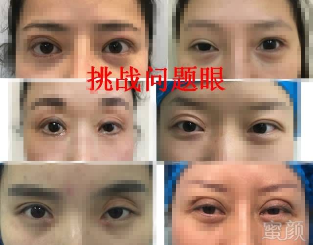 https://img.miyanlife.com/mnt/timg/190225/123541N57-1.jpg