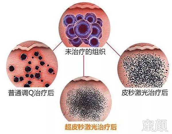 https://img.miyanlife.com/mnt/timg/190225/1236243349-6.jpg