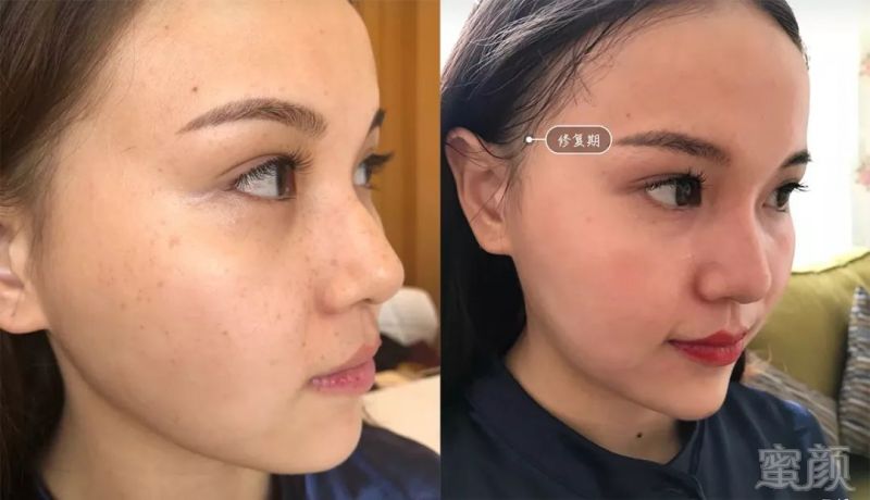 https://img.miyanlife.com/mnt/timg/190225/123GU918-4.jpg