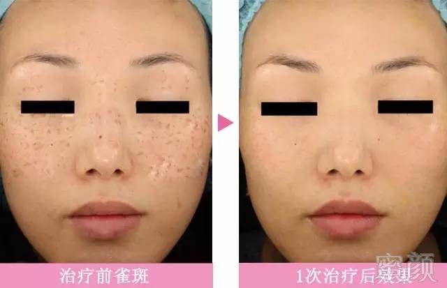 https://img.miyanlife.com/mnt/timg/190225/123T114U-4.jpg