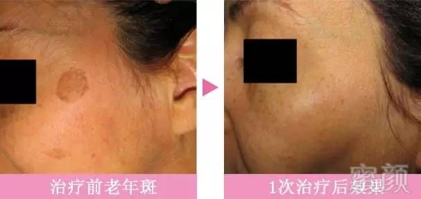 https://img.miyanlife.com/mnt/timg/190225/123T124Y-5.jpg
